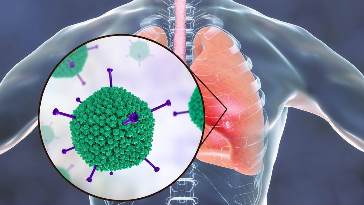 'Highly contagious' disease isn't going away anytime soon - here's what ...