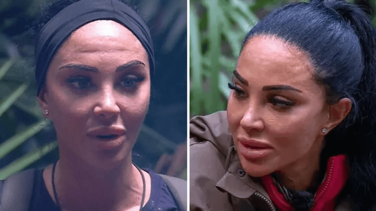 tulisa n dubz plastic surgery Image 9