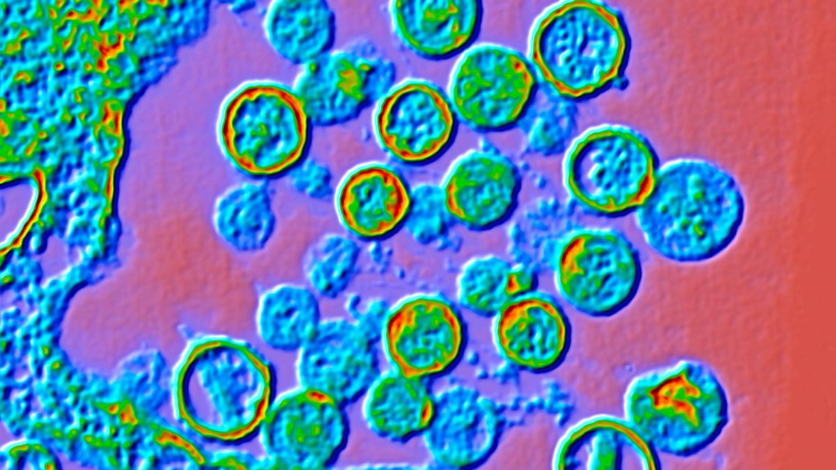 Officials share next steps for hantavirus outbreak as cases rise