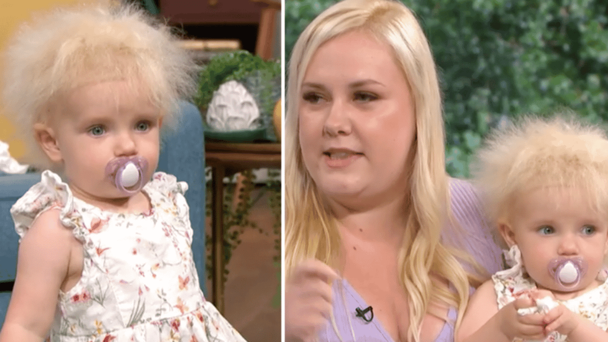Layla Davis Little Girl Diagnosed With Uncombable Hair Syndrome