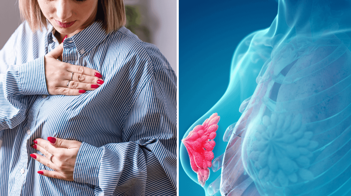 Why you need to seek help if your breast turns specific colour