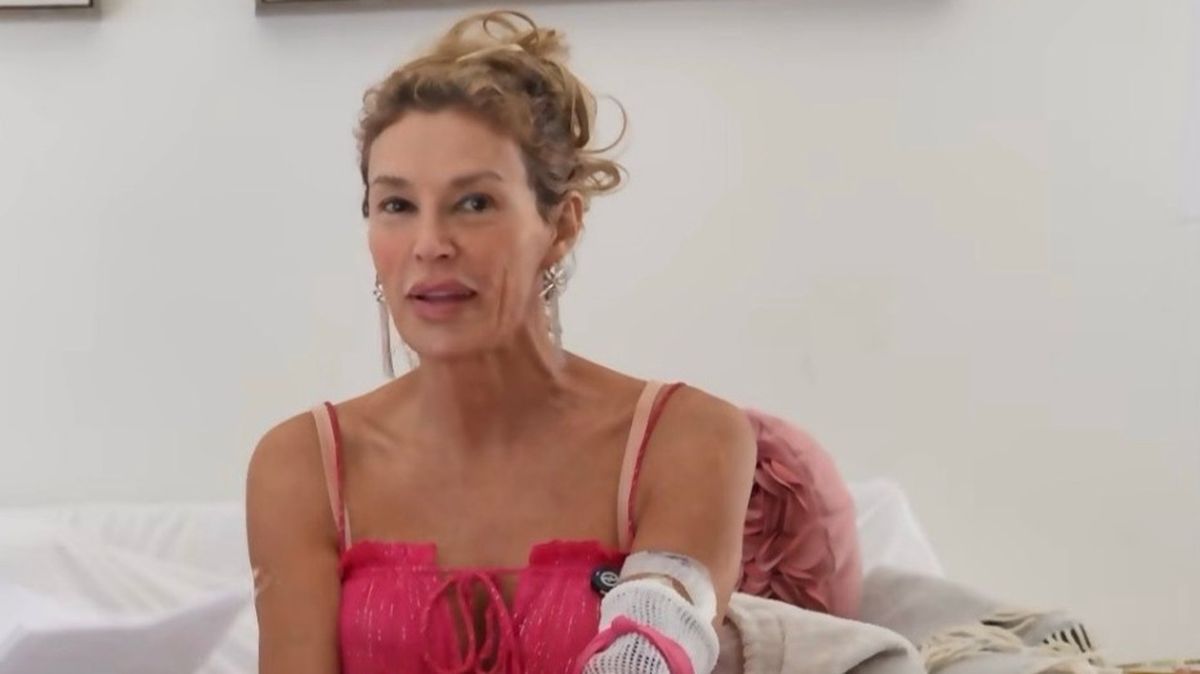 Brandi Glanville breaks down in tears over GoFundMe for facial disfigurement battle