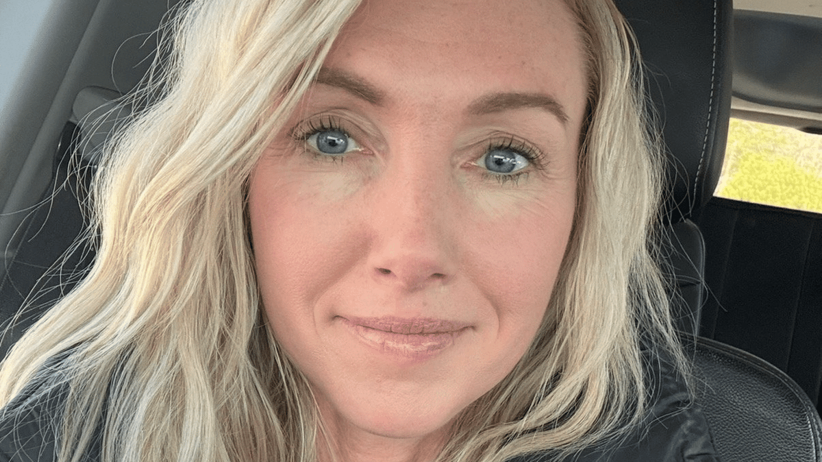 Woman Issues Urgent Warning After Botox Nightmare Left Her Suffering For Two Years