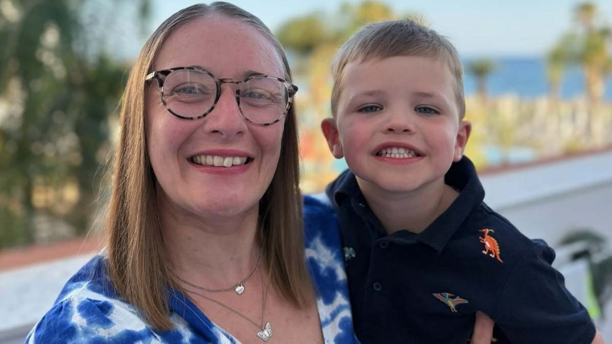 Mom opens up about son's rare condition that caused his skin to 'peel off in the bath' as a baby