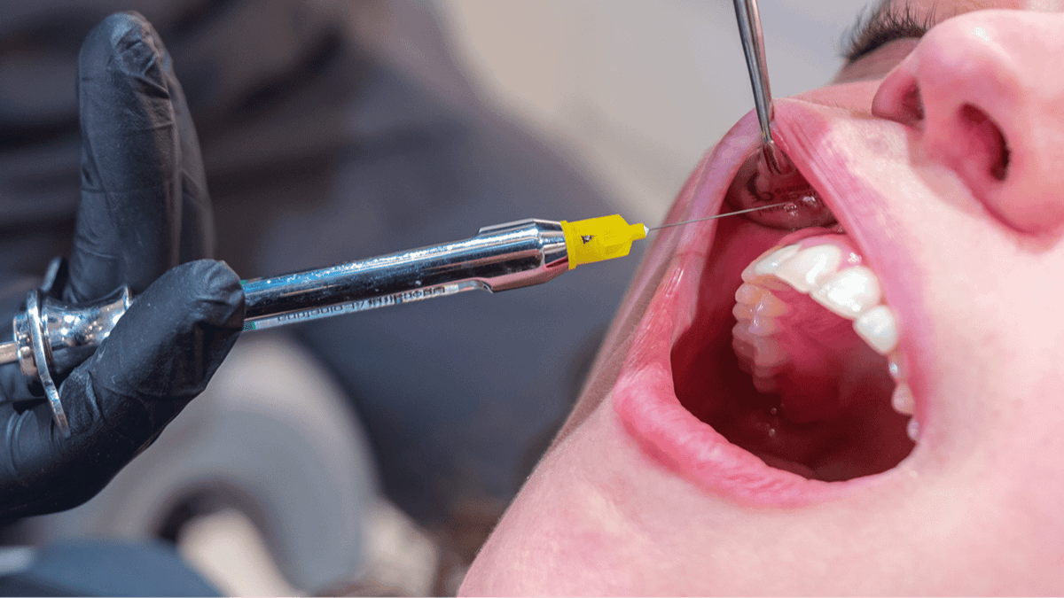 Wisdom teeth are known for causing misery, but there's a clever reason behind their name