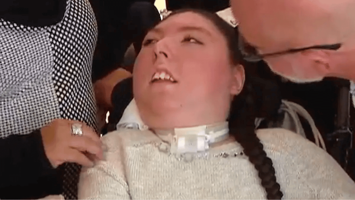 Woman born without a brain turns 20 as family describe 'miracle'