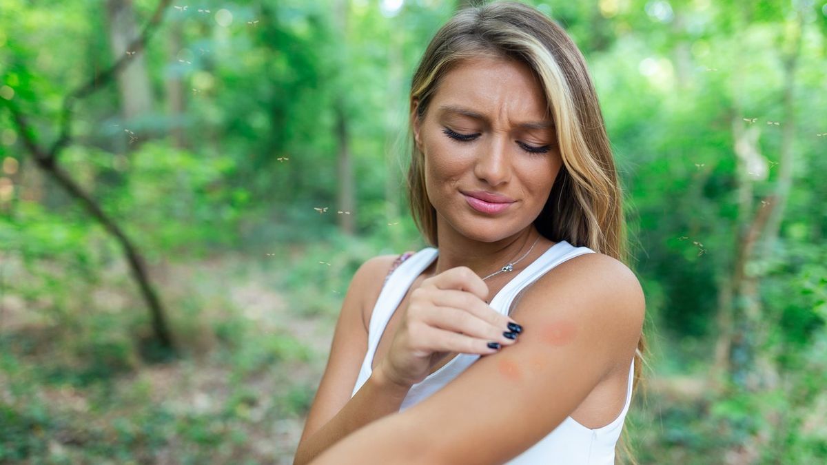 Expert Explains Why You Should Resist Scratching Bug Bites No Matter How Good It Feels