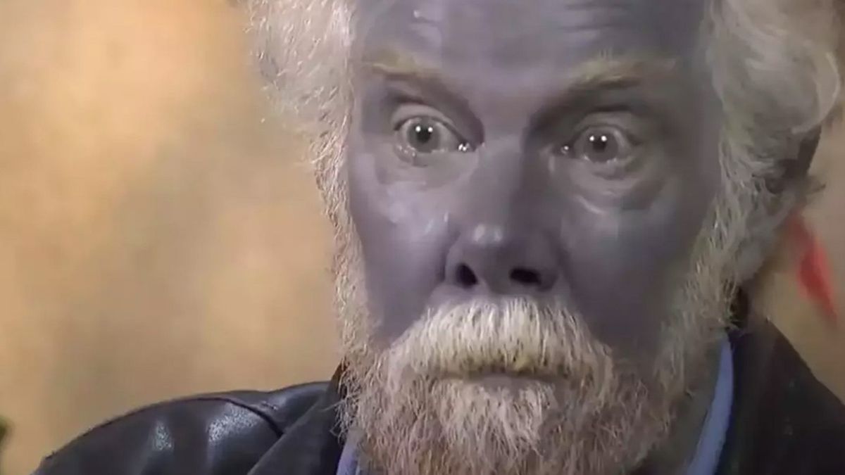 Strange story behind man who permanently turned himself blue after ...