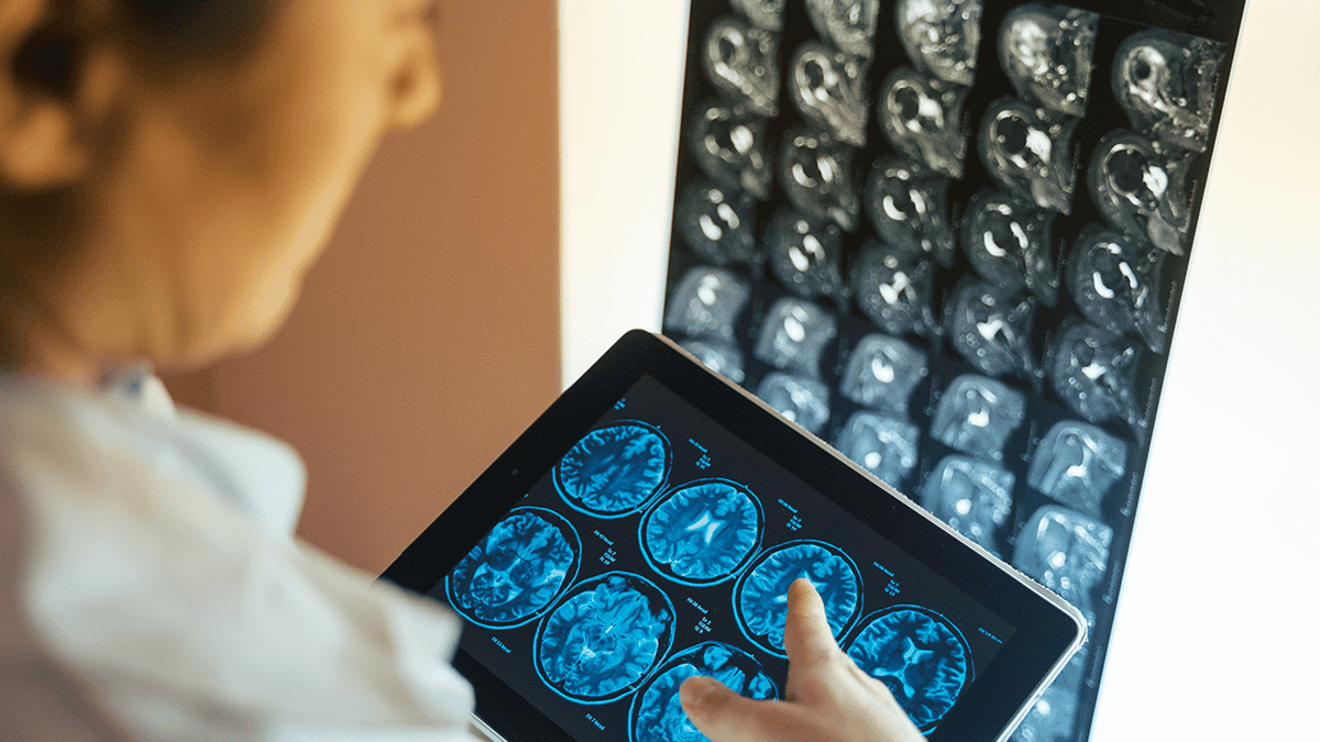 Scientists make groundbreaking discovery about Alzheimers that could ...