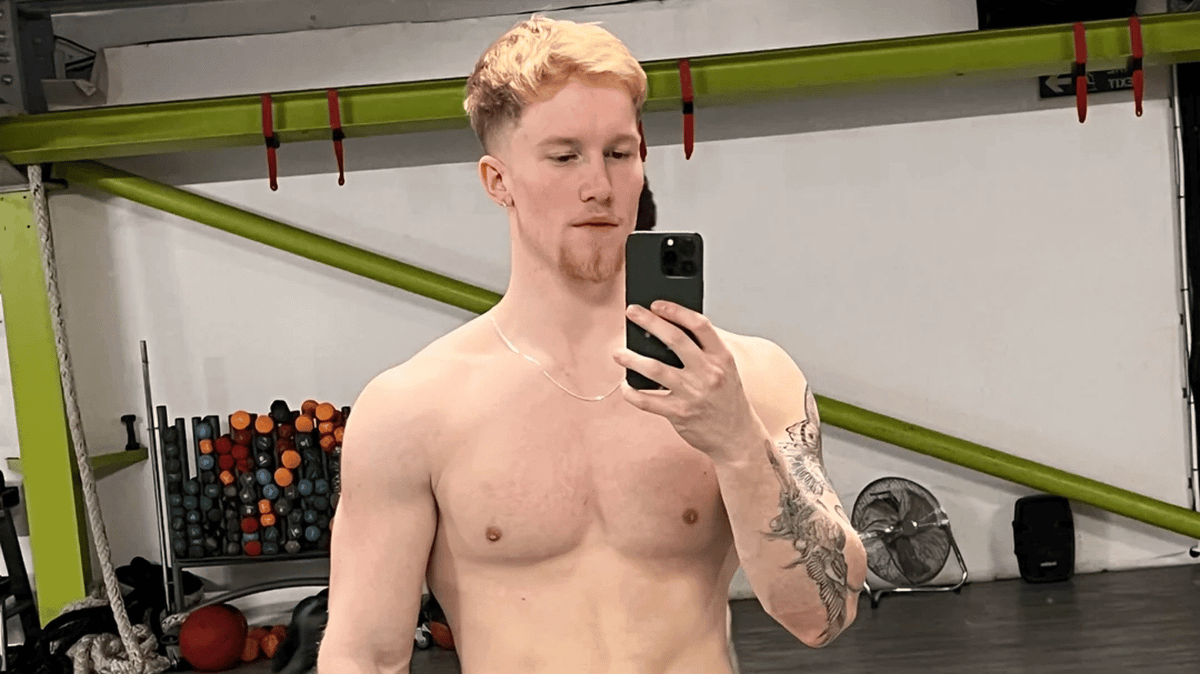 Man who spent three months injecting Melanotan II explains risky side  effects he saw straight away