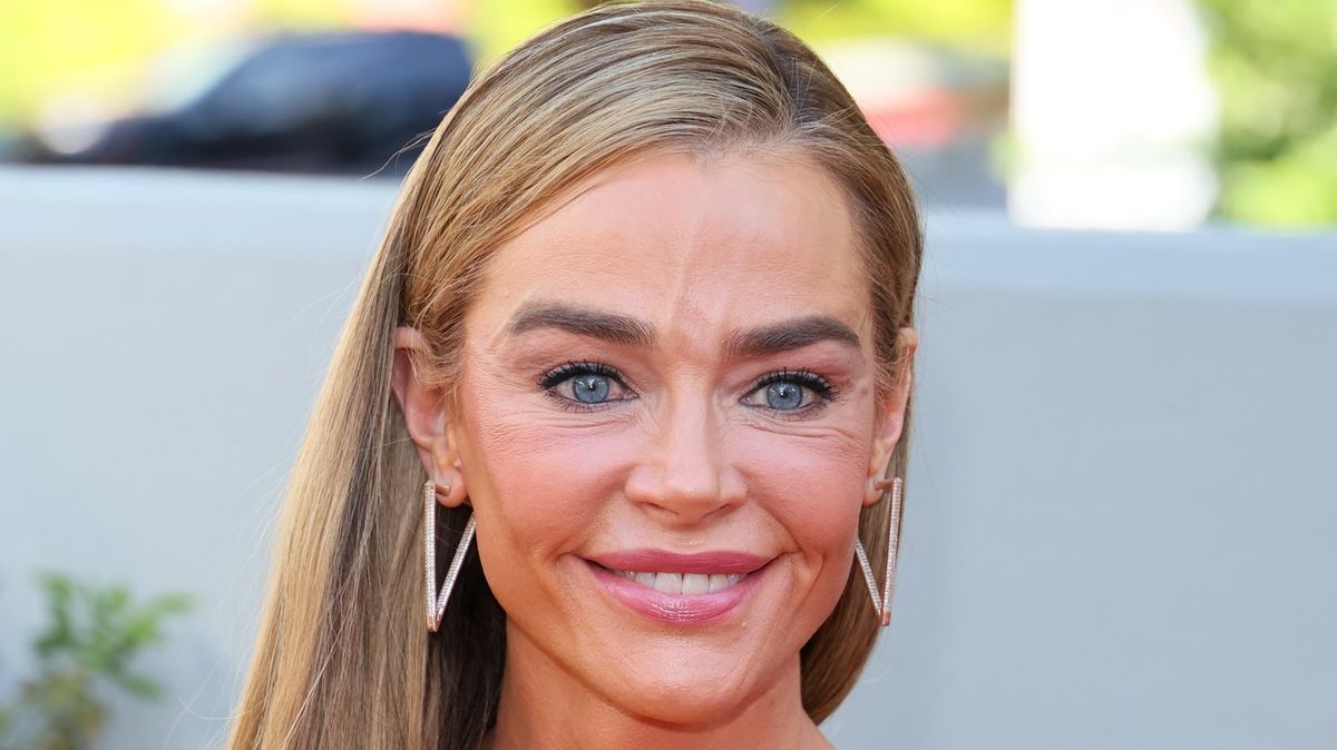 Denise Richards’ $200K Facelift Fuels ‘The Substance’ Comparisons As Before-And-After Photos Spark ‘Head Transplant’ Comments