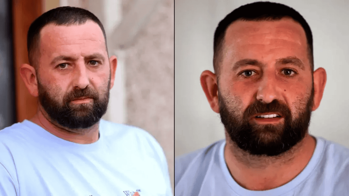 Brit explains why £14,000 botched Turkey teeth procedure was 'the worst ...