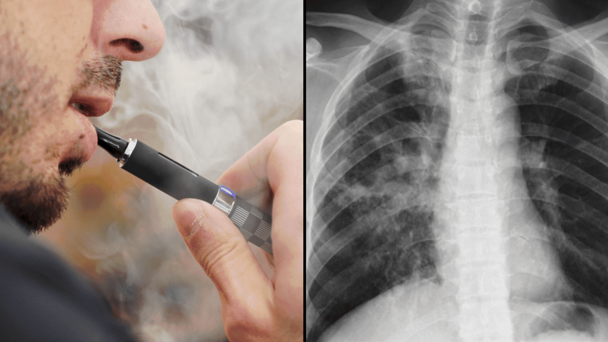 Timeline of what happens to your body when you quit vaping