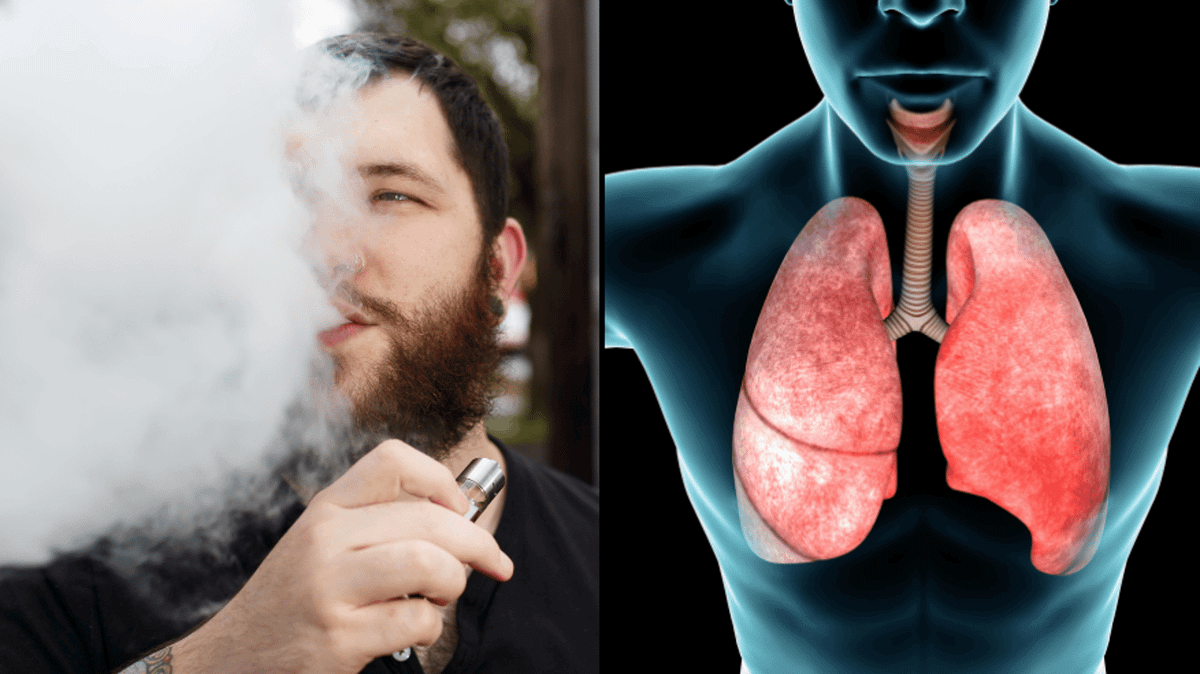 kiwi 2 vape Is Vaping Giving You Popcorn Lung? main image 0