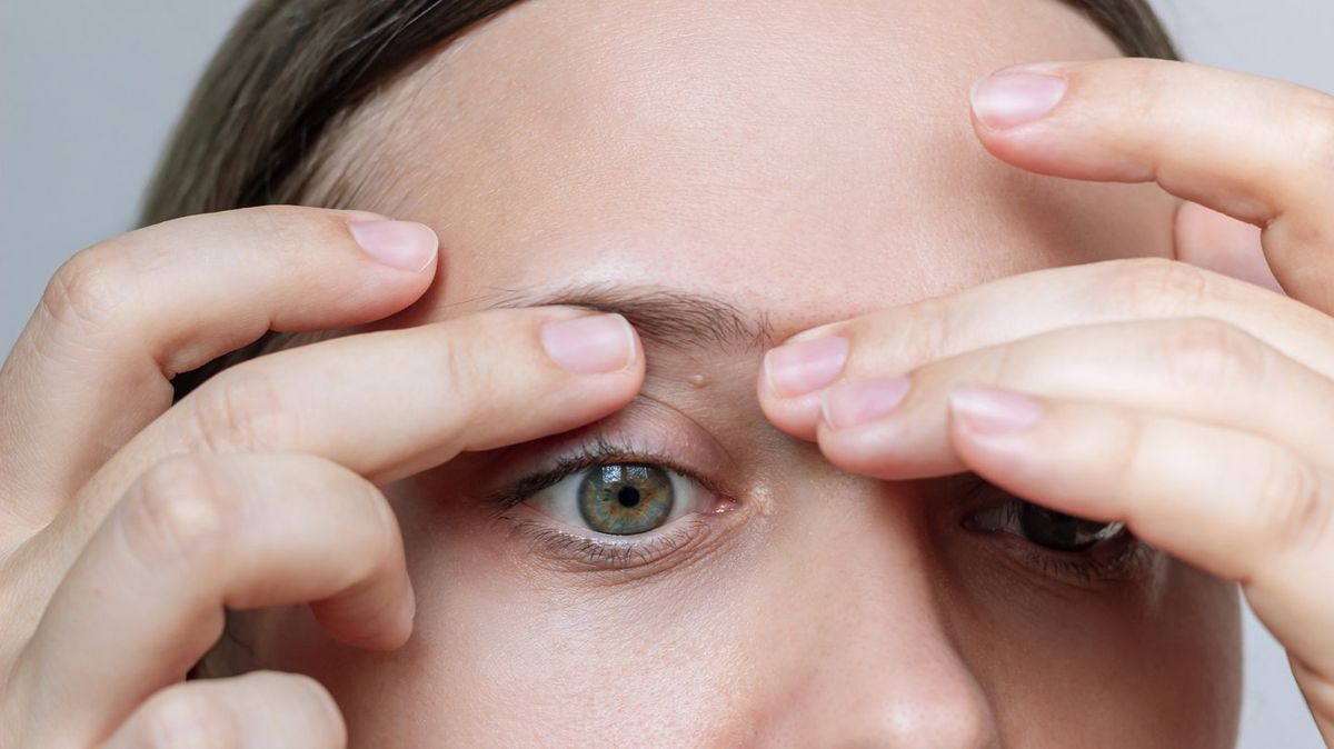 Warning to people who have small white spots as doctor explains how to get rid of them