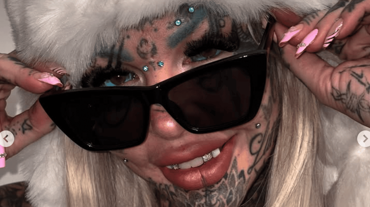 'Most tattooed woman' posts first post-op photos after flying 21 hours for 'highly illegal' surgery