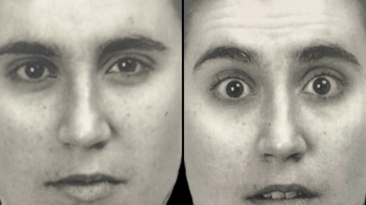 Doctor shares test he uses to help see if patients might be autistic