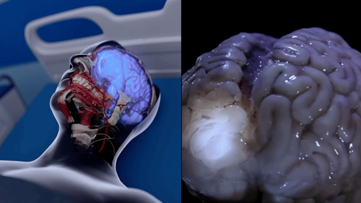 Realistic simulation shows what happens to our brains within 10 minutes