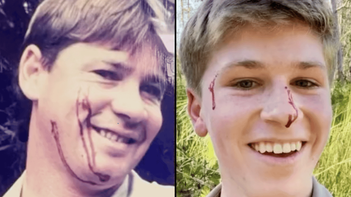 Robert Irwin shares video of him being bitten by same species of snake ...