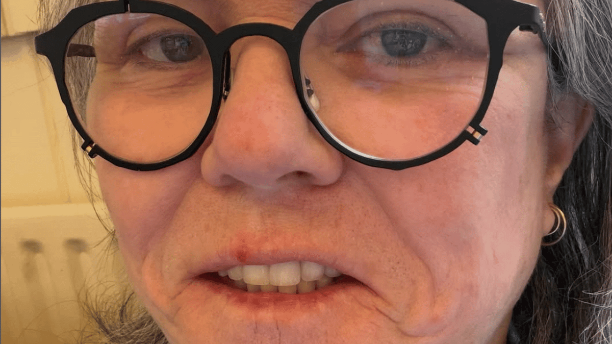 Comedian Rosie O'Donnell shares candid pics of 'shameful' facelift that costs more than any car she's bought