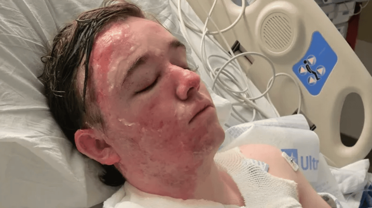 McDonald's worker left in ICU after coworker allegedly threw hot oil at him