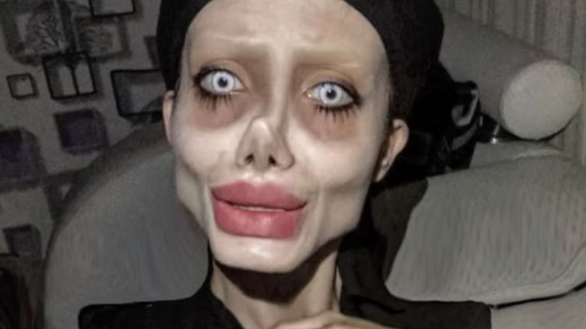 What happened to ‘Zombie Angelina Jolie' after showing real face and leaving spotlight