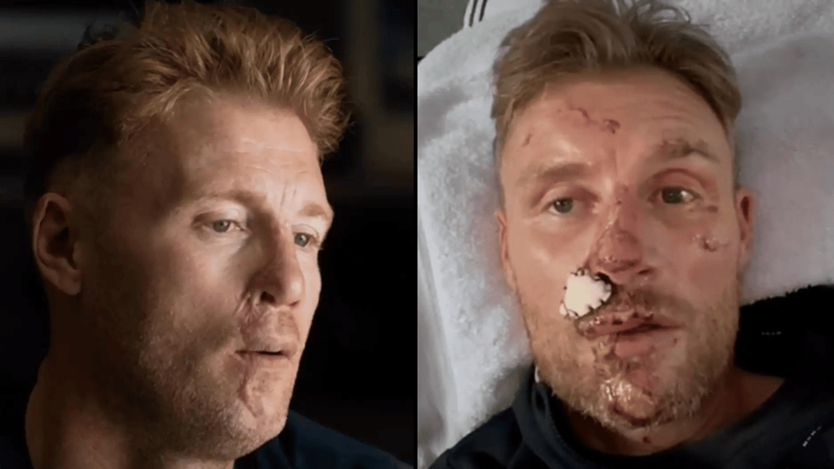 Freddie Flintoff speaks out on 'life-changing' Top Gear crash after ...