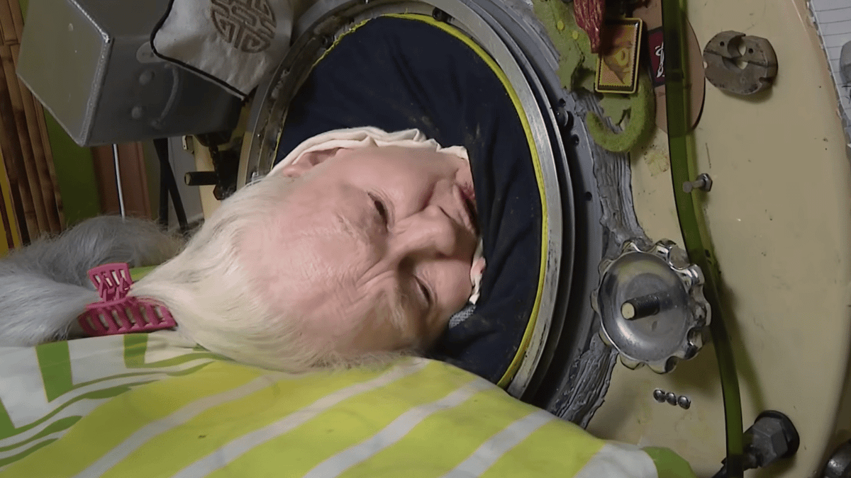 Woman, 78, who was last polio survivor to live in iron lung passes away because machine was too old to repair