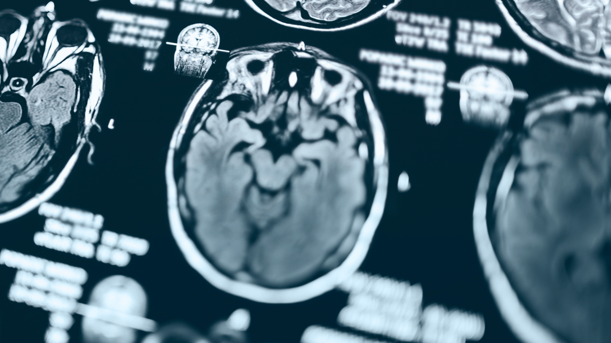 Man freaks out after trying potent ‘God molecule' drug that completely reorganizes brain activity