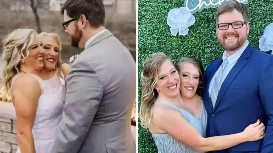 Conjoined twin Brittany Hensel's rights now her sister is legally married