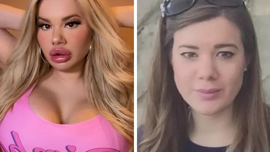 Woman says family abandoned her after spending over 10,000 to look like a 'bimbo doll' Woman says family abandoned her after spending over 10,000 to look like a 'bimbo doll'