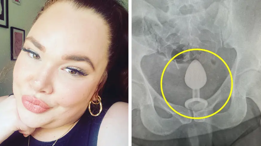 Mortified' woman rushed to A&E after getting adult toy stuck inside her