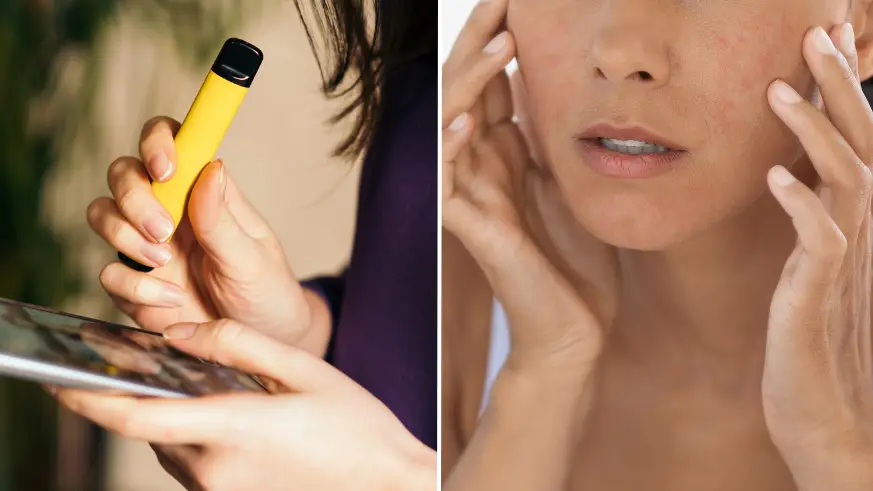 Expert reveals the dangers vaping can have on your skin