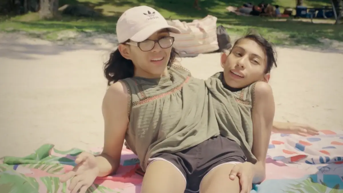 Conjoined twin reveals what happens when sister is intimate with her husband