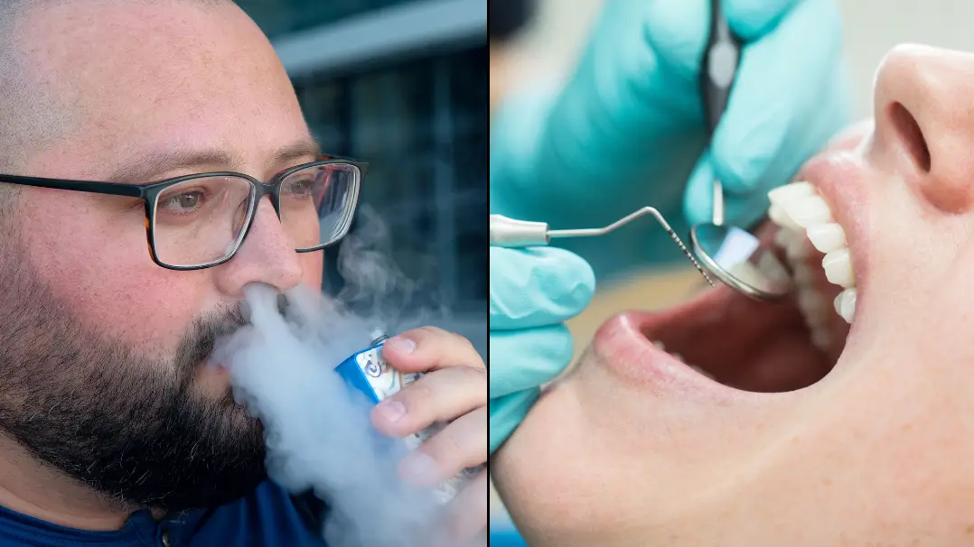 vapers mouth Vapers Tongue: Understanding the Phenomenon and How to Cure It – SMOKO E  Cigarettes