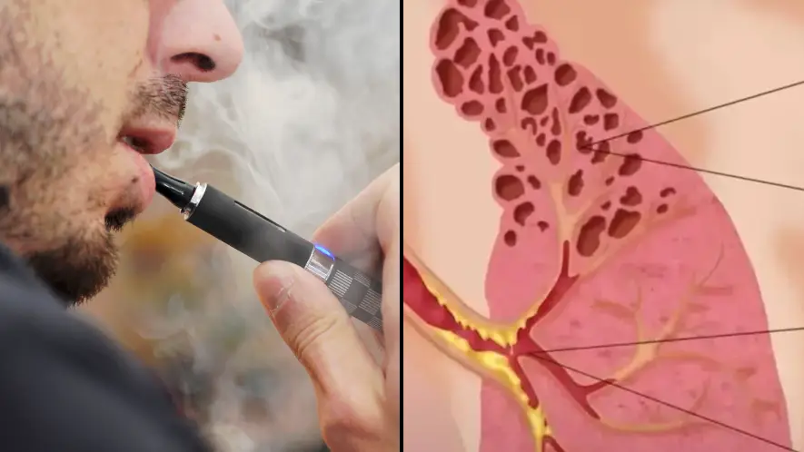 Do You Inhale Vape Smoke Into Your Lungs Smoking and vaping are often  compared, but neither is harmless. While they work differently, both can  expose the lungs to addictive nicotine and harmful