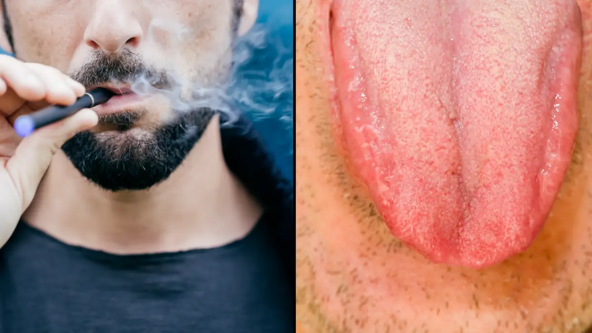 tongue feels weird after smoking cigarettes Dentist issues warning to smokers over 'vaper's tongue'