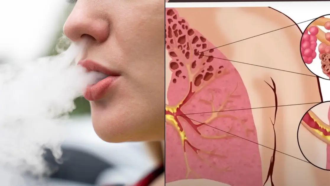 Sobering simulation shows what really happens to your body when you inhale  smoke from a vape