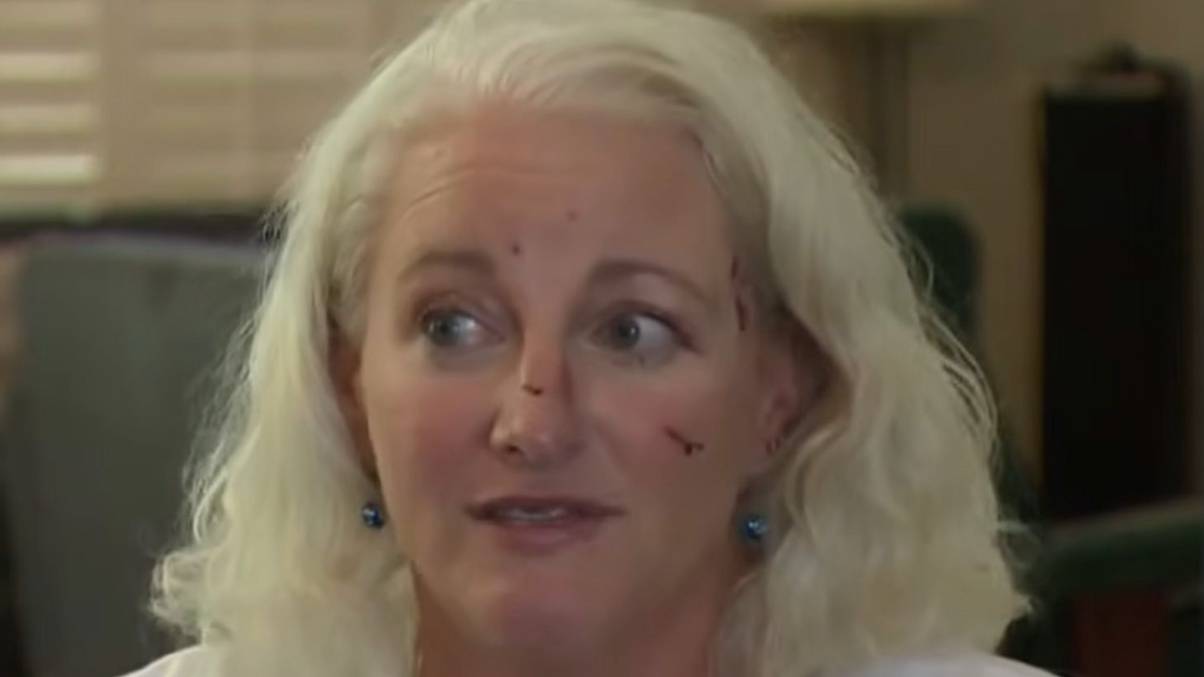 Woman left needing 38 stitches after being attacked by ‘relentless’ otter while swimming