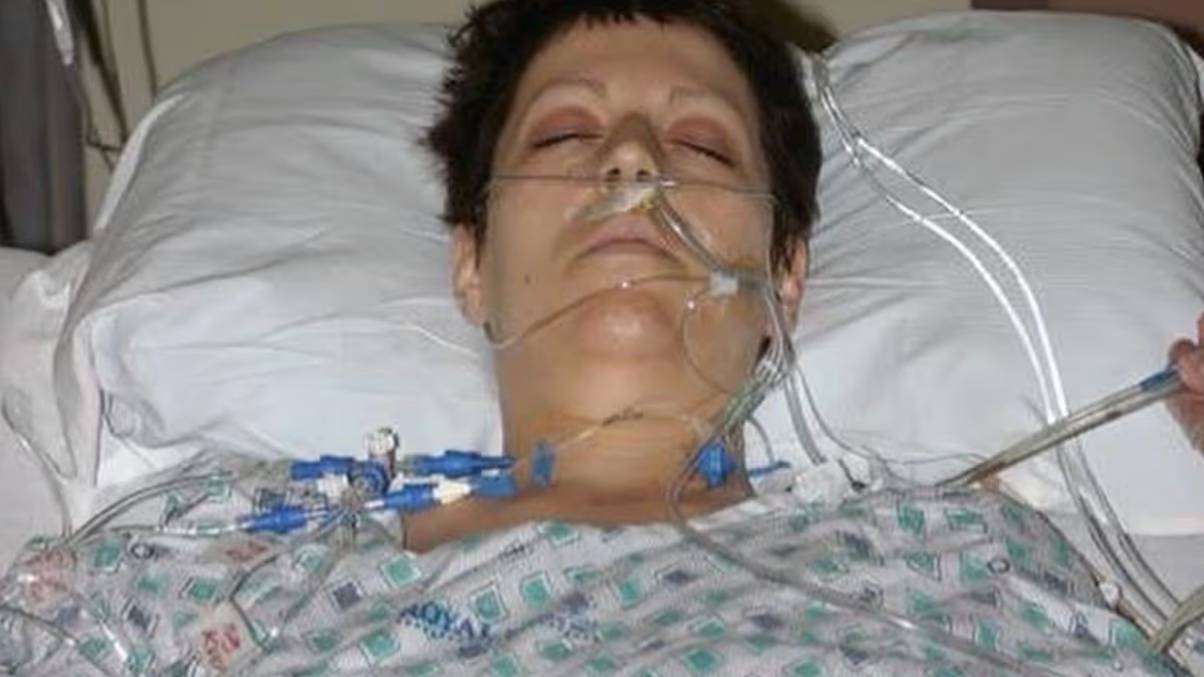 Woman given 15 months to live after wearing her dad's coat gave her cancer