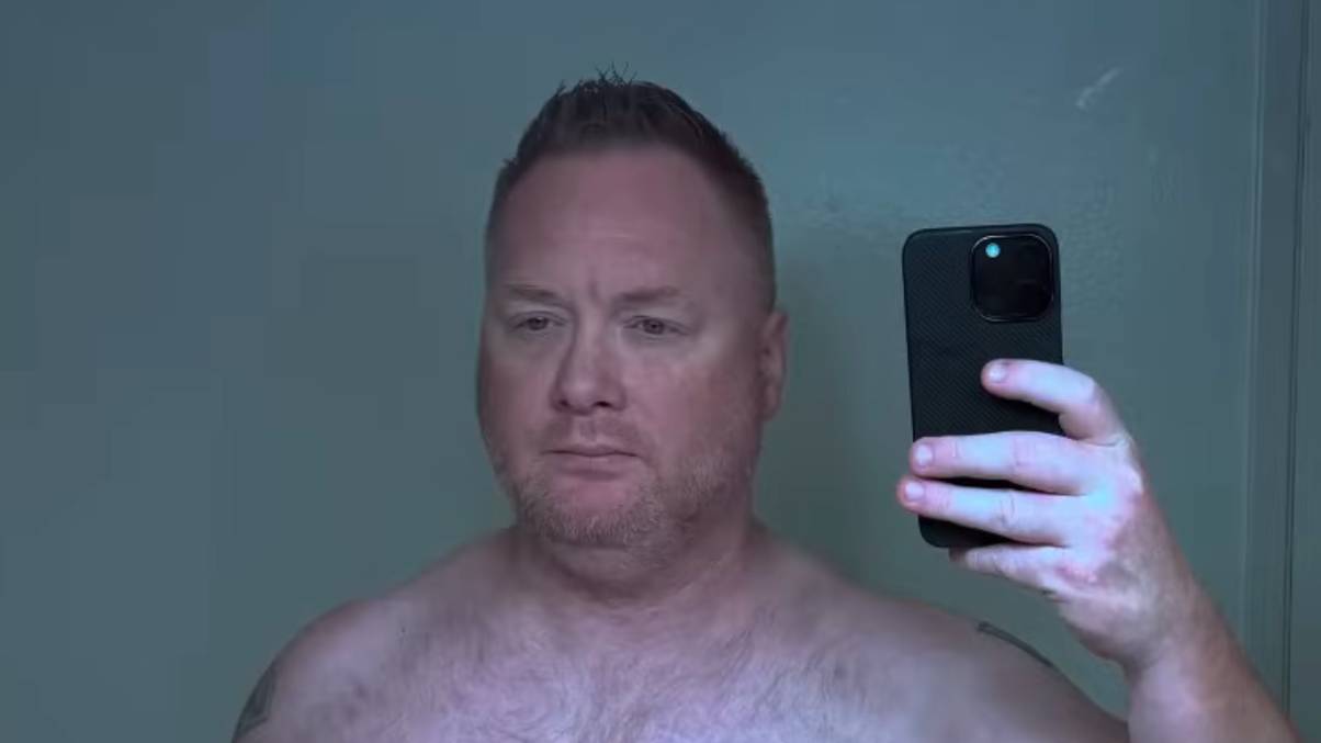 Man shares before and after of taking ‘world’s most powerful weight loss drug’ for one month