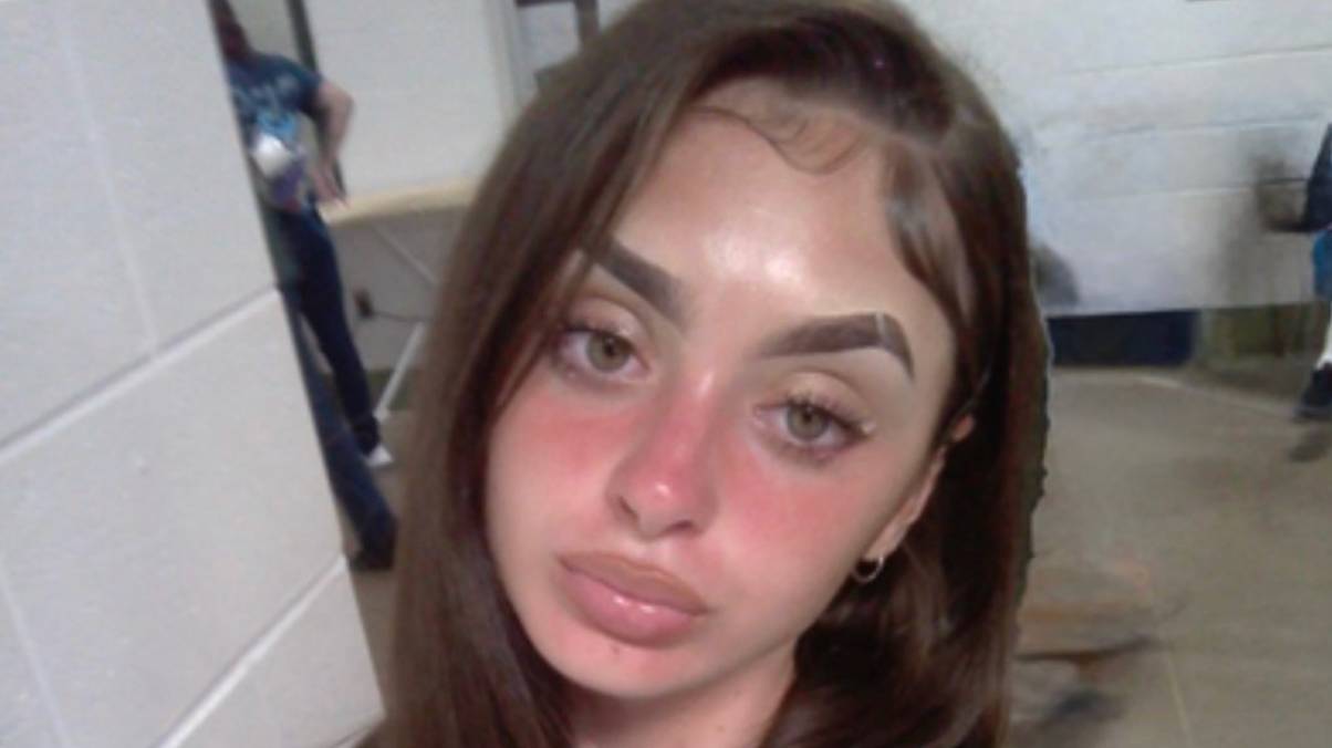 How Mackenzie Shirilla was able to take viral prison selfie with 'lip filler' from prison