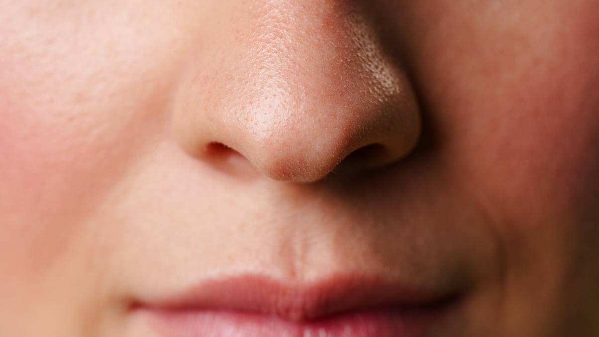 Signs of 'ketamine nose' that can occur after taking drug