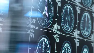 TEK IMAGE/SCIENCE PHOTO LIBRARY/Getty Images