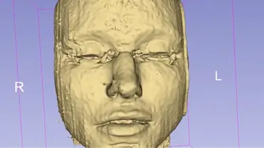 Kami Parsa, M.D. via YouTube