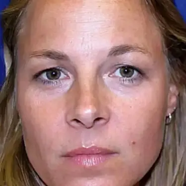 American Society for Dermatologic Surgery