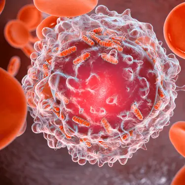 KATERYNA KON/SCIENCE PHOTO LIBRARY / Getty