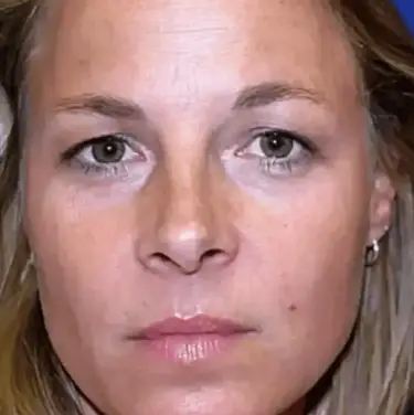 American Society for Dermatologic Surgery