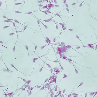 Sebastian Condrea/Getty Images