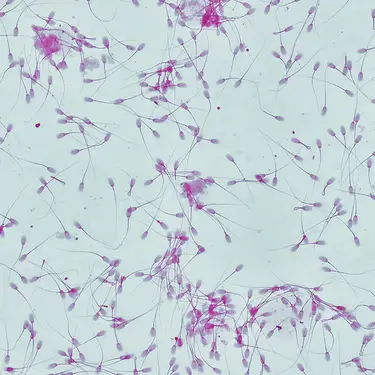 Sebastian Condrea / Getty